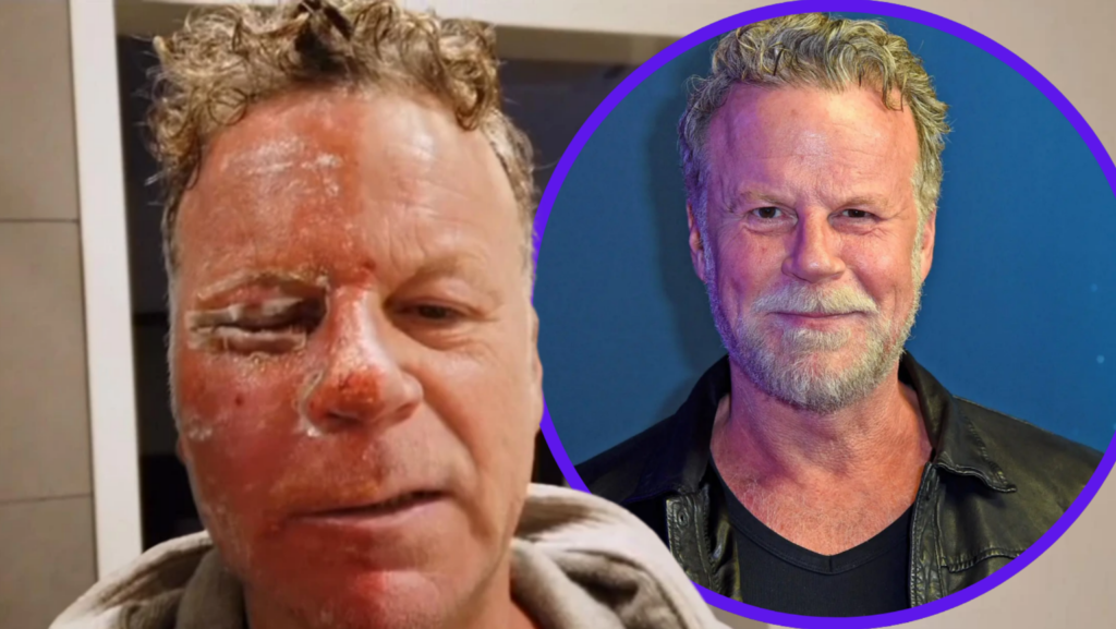 Jenke Schönheits-OP: Wahrheit & Hintergründe Jenke Schönheits-OP – TV-Experiment zur ästhetischen Medizin